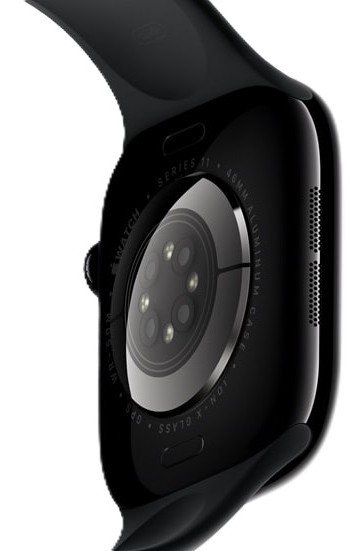 Apple-Watch-Series-11